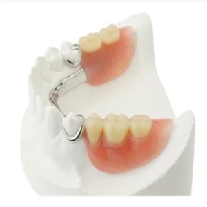 دندان مصنوعی ثابت چسبی یا چسبیده چیست : انواع + کاربرد + مشاوره رایگان