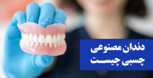 دندان مصنوعی چسبی چیست
