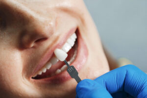 دندان مصنوعی برای لثه صاف