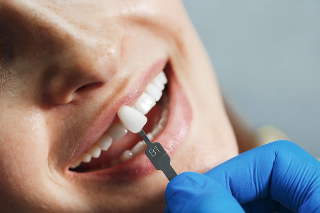 دندان مصنوعی برای لثه صاف