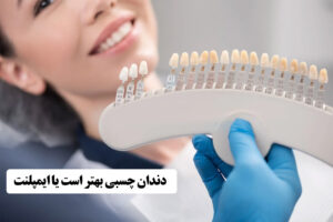 دندان چسبی بهتر است یا ایمپلنت