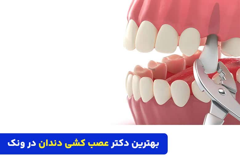 بهترین دکتر و متخصص عصب کشی دندان در ونک