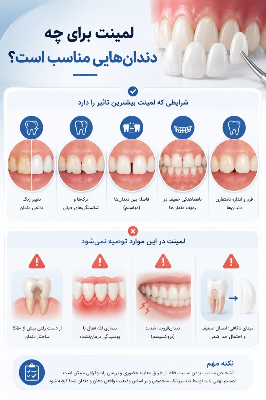 لمینت برای چه دندانهایی مناسب است