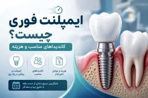 ایمپلنت دندان